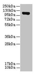 DENND2C Polyclonal Antibody