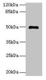ADAL Polyclonal Antibody
