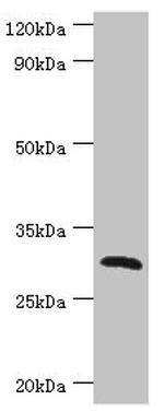 CLEC12A Antibody in Western Blot (WB)