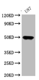 ATAT1 Polyclonal Antibody