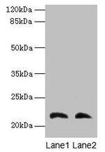 LGALS9C Polyclonal Antibody