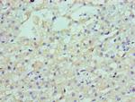 LDLRAP1 Polyclonal Antibody