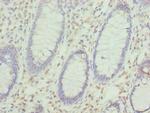 KHDRBS2 Polyclonal Antibody