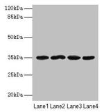 METRNL Polyclonal Antibody