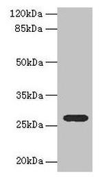 TEX35 Antibody in Western Blot (WB)