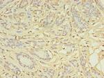 CCP2 Polyclonal Antibody