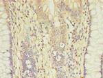 CCP2 Antibody in Immunohistochemistry (Paraffin) (IHC (P))
