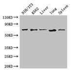 IL23R Antibody in Western Blot (WB)