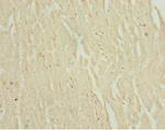 NHLRC1 Antibody in Immunohistochemistry (Paraffin) (IHC (P))