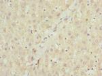 NHLRC1 Polyclonal Antibody