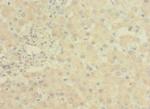 LRRC31 Antibody in Immunohistochemistry (Paraffin) (IHC (P))