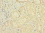 LRRC31 Polyclonal Antibody