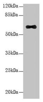 LRRC31 Antibody in Western Blot (WB)
