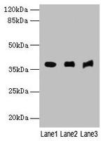 C5orf45 Polyclonal Antibody