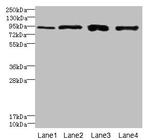 XRRA1 Antibody in Western Blot (WB)