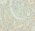 SLC39A4 Polyclonal Antibody