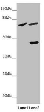 SLC39A4 Antibody in Western Blot (WB)