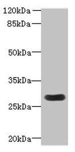 MORN3 Polyclonal Antibody
