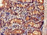 IL-34 Polyclonal Antibody