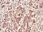 FBXL22 Antibody in Immunohistochemistry (Paraffin) (IHC (P))
