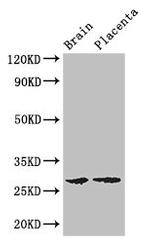 FBXL22 Antibody in Western Blot (WB)