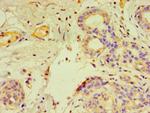 GTF2H2C Antibody in Immunohistochemistry (Paraffin) (IHC (P))