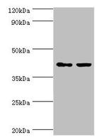 GTF2H2C Antibody in Western Blot (WB)