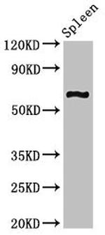 CNKSR3 Antibody in Western Blot (WB)