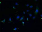 CCDC108 Polyclonal Antibody
