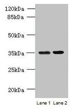 CCDC108 Antibody in Western Blot (WB)