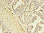 SLC25A25 Antibody in Immunohistochemistry (Paraffin) (IHC (P))