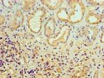 ALKBH2 Antibody in Immunohistochemistry (Paraffin) (IHC (P))