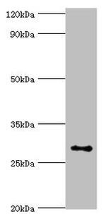 ALKBH2 Antibody in Western Blot (WB)