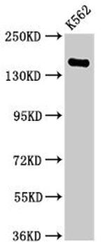 FGD6 Antibody in Western Blot (WB)