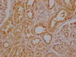 USP30 Polyclonal Antibody