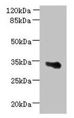 ARMCX6 Antibody in Western Blot (WB)
