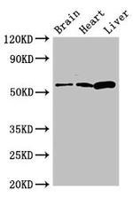 CPEB2 Antibody in Western Blot (WB)