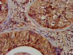 NIT1 Antibody in Immunohistochemistry (Paraffin) (IHC (P))