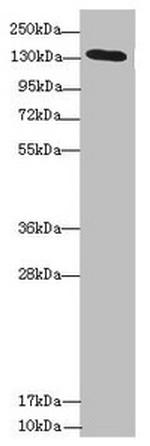 NPHP3 Polyclonal Antibody