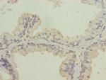 ISCA2 Polyclonal Antibody
