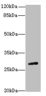 TBC1D26 Polyclonal Antibody