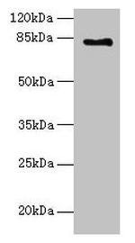 LCA5 Polyclonal Antibody