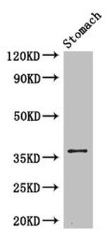 PIM3 Polyclonal Antibody