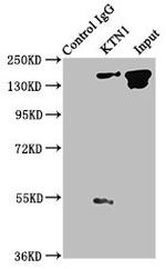 KTN1 Antibody in Immunoprecipitation (IP)