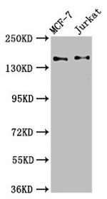 KTN1 Antibody in Western Blot (WB)