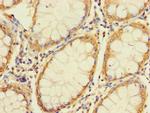 UNC93A Polyclonal Antibody