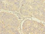 CIR1 Polyclonal Antibody