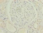 C5orf24 Polyclonal Antibody