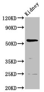 PIGW Polyclonal Antibody