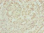 ERO1LB Polyclonal Antibody